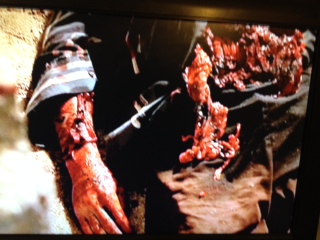 Arms and (what's left of the man!)